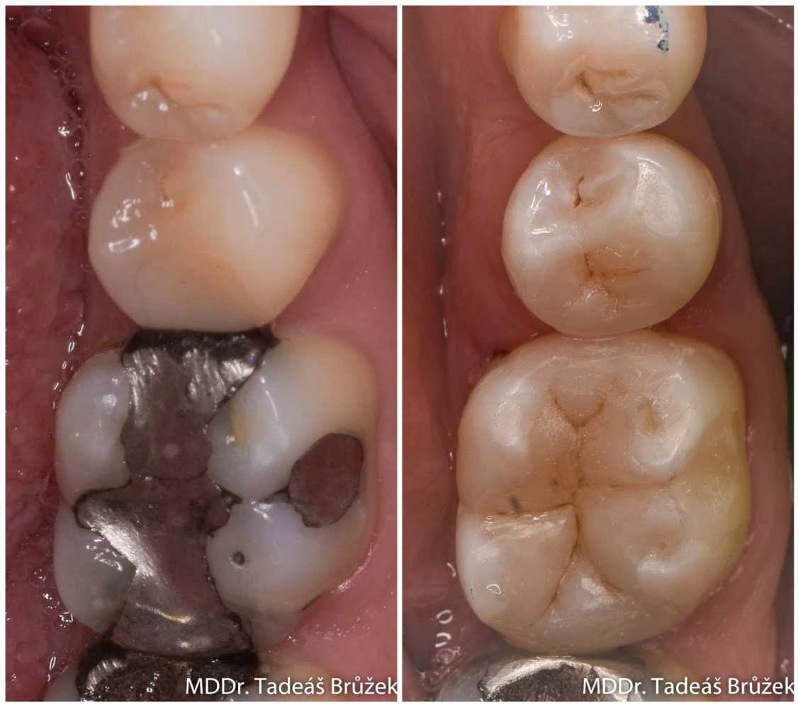 Treatment options
